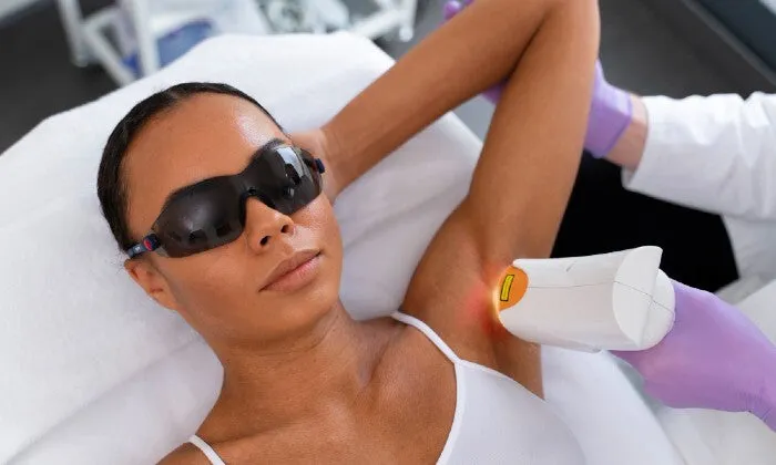 3 x Laser Hair Removal Sessions at Chaz De Beau